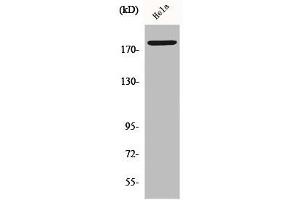 Western Blot analysis of HepG2 cells using Phospho-Neu (Y877) Polyclonal Antibody (ErbB2/Her2 antibody  (pTyr877))