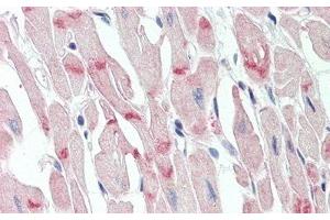 Detection of DSG2 in Human Heart Tissue using Polyclonal Antibody to Desmoglein 2 (DSG2) (Desmoglein 2 antibody  (AA 275-533))
