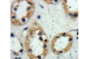 Used in DAB staining on fromalin fixed paraffin-embedded Kidney tissue (PIGR antibody  (AA 230-331))