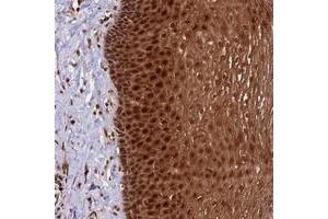 Immunohistochemical staining of human esophagus with DHX38 polyclonal antibody  shows strong cytoplasmic and nuclear positivity in squamous epithelial cells at 1:50-1:200 dilution.