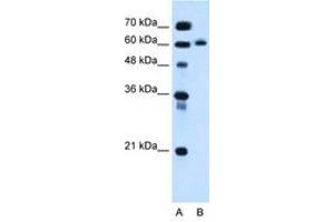 Image no. 1 for anti-Inositol 1,4,5-Triphosphate Receptor Interacting Protein-Like 1 (ITPRIPL1) (AA 402-451) antibody (ABIN6736675) (ITPRIPL1 antibody  (AA 402-451))