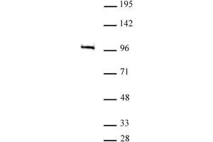 MED15 antibody (pAb) tested by Immunoprecipitation. (MED15 antibody  (C-Term))
