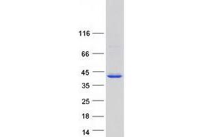 Ankyrin Repeat Domain 16 (ANKRD16) (Transcript Variant 1) protein (Myc-DYKDDDDK Tag)
