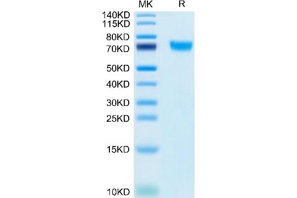 Phospholipase D4 Protein (PLD4) (AA 52-506) (His tag)