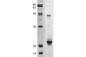 Validation with Western Blot (APBA3 Protein (His tag))