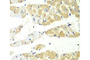 Immunohistochemistry of paraffin-embedded Mouse heart using TBXAS1 Polyclonal Antibody at dilution of 1:100 (40x lens). (TBXAS1 antibody)