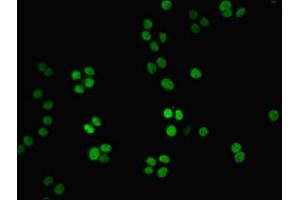 Immunofluorescent analysis of PC-3 cells using ABIN7161579 at dilution of 1:100 and Alexa Fluor 488-congugated AffiniPure Goat Anti-Rabbit IgG(H+L) (NMNAT1 antibody  (AA 1-279))