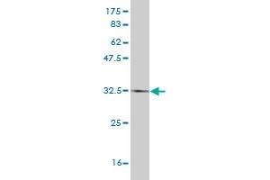 Western Blot detection against Immunogen (34. (HAND2 antibody  (AA 135-216))