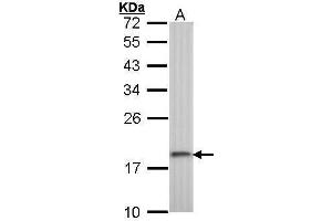 WB Image Sample (30 ug of whole cell lysate) A: A431 , 12% SDS PAGE antibody diluted at 1:1000 (RPS10 antibody)