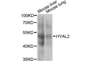 Western blot analysis of extracts of various cell lines, using HYAL2 antibody (ABIN2563308) at 1:1000 dilution. (HYAL2 antibody)