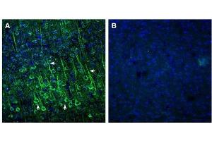Expression of EphA2 in mouse cortex. (EPH Receptor A2 antibody  (Extracellular, N-Term))