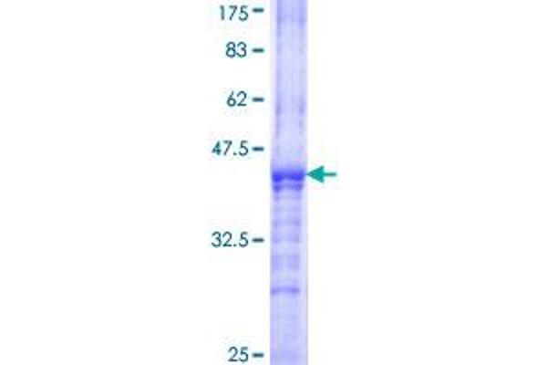 ST8SIA2 Protein (AA 40-146) (GST tag)