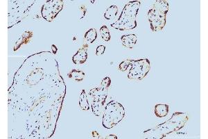 IHC analysis of Cyclophilin E/PPIE using anti-Cyclophilin E/PPIE antibody (ABIN7599243). (PPIE antibody  (AA 1-301))