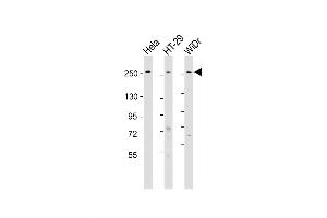 Western Blot at 1:1000-1:2000 dilution Lane 1: Hela whole cell lysate Lane 2: HT-29 whole cell lysate Lane 3: WiDr whole cell lysate Lysates/proteins at 20 ug per lane.