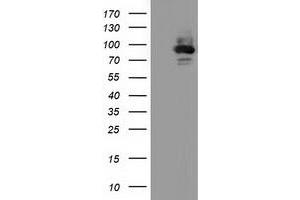 HEK293T cells were transfected with the pCMV6-ENTRY control (Left lane) or pCMV6-ENTRY ALDH1L1 (Right lane) cDNA for 48 hrs and lysed. (ALDH1L1 antibody)