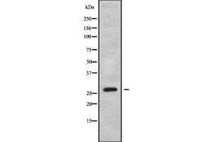 Western blot analysis OTUB2 using HepG2 whole cell lysates (OTUB2 antibody  (Internal Region))
