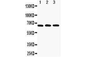 Anti-RANK antibody, Western blotting Lane 1: Recombinant Human RANK Protein 10ng Lane 2: Recombinant Human RANK Protein 5ng Lane 3: Recombinant Human RANK Protein 2. (TNFRSF11A antibody  (N-Term))