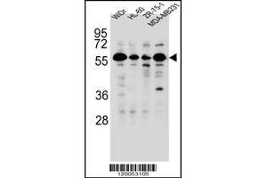 Western blot analysis in WiDr,HL-60,ZR-75-1,MDA-MB231 cell line lysates (35ug/lane). (FOXC2 antibody  (AA 183-210))
