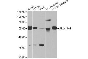 Western blot analysis of extracts of various cell lines, using ALDH3A1 antibody. (ALDH3A1 antibody)
