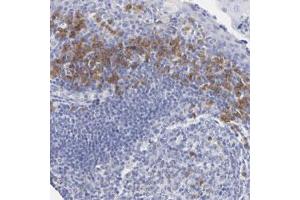 Immunohistochemical staining of human tonsil with LAX1 polyclonal antibody  shows cytoplasmic positivity in lymphoid cells outside reaction centra at 1:50-1:200 dilution. (LAX1 antibody)