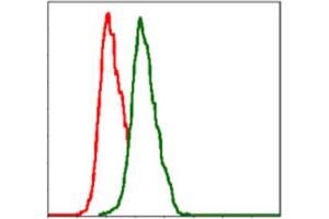 Immunohistochemical analysis of paraffin-embedded cervical cancer tissues using ITGB1 antibody with DAB staining. (ITGB1 antibody)