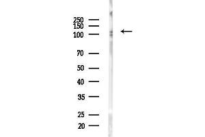 Western blot analysis of lysates from MDA-MB-231 cells(heat-shock,45 min treatment), using ATP1 Antibody at 1/1000 dilution.
