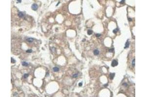 Immunohistochemical analysis of paraffin-embedded human fetal liver showing cytoplasmic staining with HINT2 polyclonal antibody  at a 1 : 100 dilution. (HINT2 antibody  (AA 59-163))
