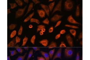 Immunofluorescence analysis of L-929 cells using N-WASP Polyclonal Antibody at dilution of 1:100 (40x lens). (Neural Wiskott-Aldrich syndrome protein (WASL) antibody)