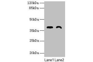 Western blot All lanes: TMEM255A antibody at 6 μg/mL Lane 1: Mouse stomach tissue Lane 2: Mouse heart tissue Secondary Goat polyclonal to rabbit IgG at 1/10000 dilution Predicted band size: 39, 21, 36, 27 kDa Observed band size: 39 kDa (FAM70A antibody  (AA 110-225))
