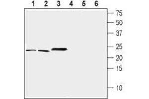 Western blot analysis of mouse brain (lanes 1 and 4), rat brain (lanes 2 and 5) and rat eye (lanes 3 and 6) lysates (1:200-1:400): - 1-3. (NCS1 antibody  (Intracellular))