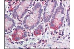 Immunohistochemistry (IHC) image for anti-Tyrosyl-DNA Phosphodiesterase 1 (TDP1) (AA 1-298), (N-Term) antibody (ABIN400858) (TDP1 antibody  (N-Term))