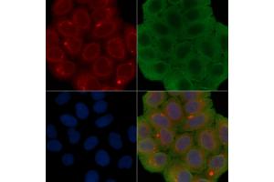 ABIN6260877 and ABIN6277178 staining Hela cells(30 min of UV treatment) by IF/ICC. (Claudin 1 antibody  (C-Term))