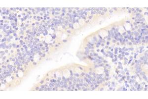 Detection of REG3a in Human Small intestine Tissue using Polyclonal Antibody to Regenerating Islet Derived Protein 3 Alpha (REG3a) (REG3A antibody  (AA 40-164))