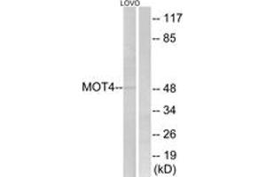 Western blot analysis of extracts from LOVO cells, using MOT4 Antibody. (SLC16A3 antibody  (AA 233-282))