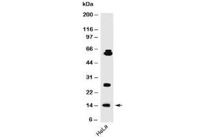 Western blot testing of human samples using SUMO1 antibody (SM1/495). (SUMO1 antibody)