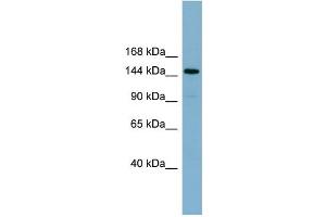 WB Suggested Anti-KIAA1199  Antibody Titration: 0. (CEMIP antibody  (Middle Region))