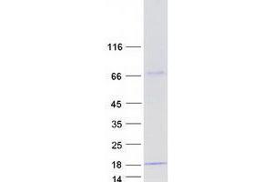 YPEL5 Protein (Transcript Variant 2) (Myc-DYKDDDDK Tag)