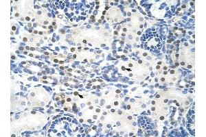 TROVE2 antibody was used for immunohistochemistry at a concentration of 4-8 ug/ml to stain Epithelial cells of renal tubule (arrows) in Human Kidney. (TROVE2 antibody  (N-Term))