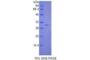 SDS-PAGE (SDS) image for Interleukin 17 Receptor D (IL17RD) (AA 356-603) protein (His tag) (ABIN2121423)