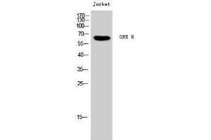 Western Blotting (WB) image for anti-G Protein-Coupled Receptor Kinase 6 (GRK6) (N-Term) antibody (ABIN3184947) (GRK6 antibody  (N-Term))