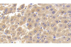 Detection of MCSFR in Mouse Liver Tissue using Polyclonal Antibody to Colony Stimulating Factor Receptor, Macrophage (MCSFR) (CSF1R antibody  (AA 639-868))