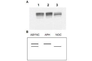 Western blot using MCM2 polyclonal antibody  shows detection of both phosphorylated and unphosphorylated MCM2 presentin nuclear extracts from elutriated human cells (MO59K/K-562). (MCM2 antibody  (AA 21-31))