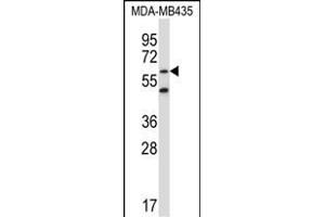 ZNF479 Antikörper  (N-Term)