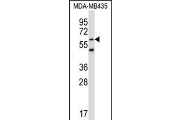 ZNF479 antibody  (N-Term)