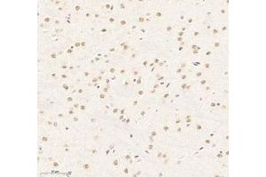 Immunohistochemistry (Paraffin-embedded Sections) (IHC (p)) image for anti-RNA Binding Motif Protein 8A (RBM8A) antibody (ABIN7075478)