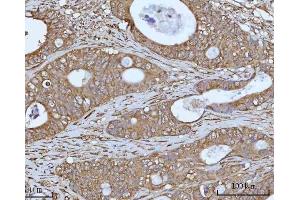IHC analysis of OCRL using anti-OCRL antibody (ABIN7599572). (OCRL antibody  (AA 1-901))