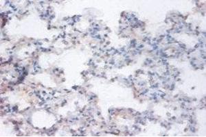 Immunohistochemistry of paraffin-embedded human lung tissue using ABIN7167205 at dilution of 1:100 (RRAGA antibody  (AA 1-247))