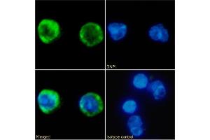 Immunofluorescence staining of fixed Human peripheral blood leukocytes with anti-MARCO antibody PLK1.