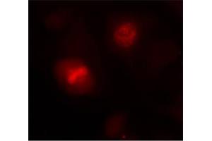 Image no. 1 for anti-Histone H3.1 (HIST1H3B) (Ser10) antibody (ABIN197332) (Histone H3.1 antibody  (Ser10))