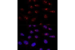 Confocal immunofluorescence analysis of U2OS cells using NOP58 Polyclonal Antibody  at dilution of 1:100. (NOP58 antibody  (AA 360-529))